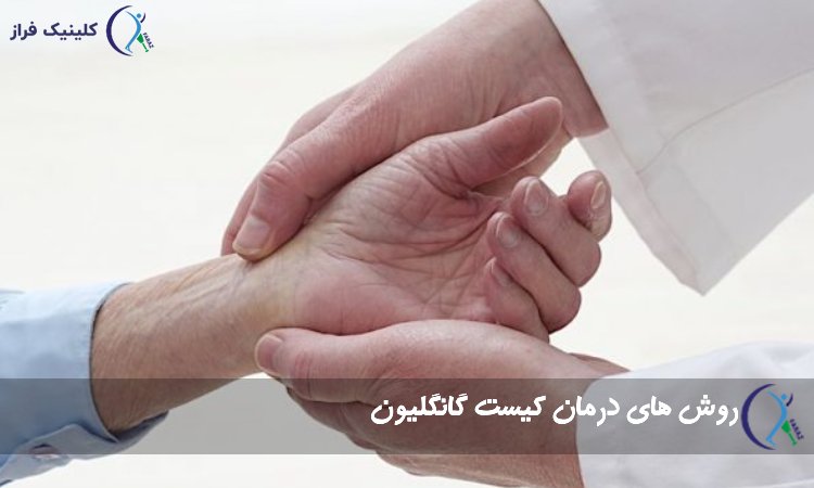 درمان کیست گانگلیون