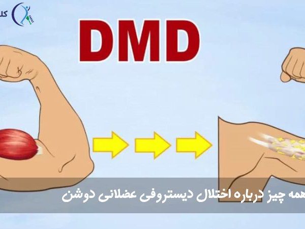 اختلال دیستروفی عضلانی دوشن