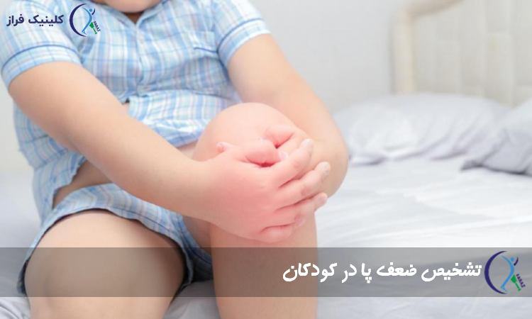 تشخیص و علائم ضعف پا 