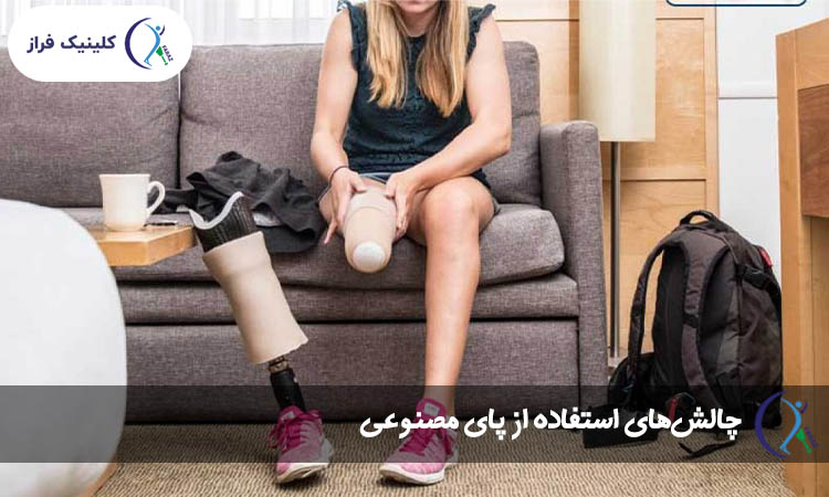 چالش های پای مصنوعی