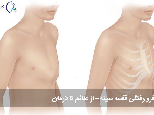 فرو رفتگی قفسه سینه