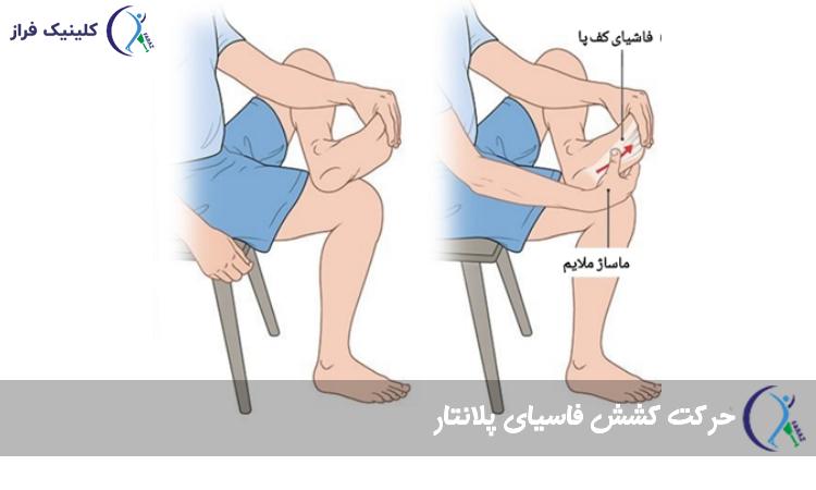 کشش فاسیای پلانتار