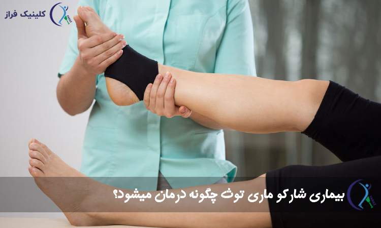 درمان بیماری شارکو ماری توث