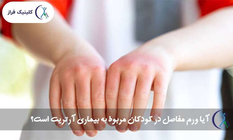 آیا ورم مفاصل در کودکان مربوط به بیماری آرتریت است؟