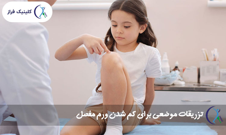 تزریقات موضعی برای کم شدن ورم مفصل