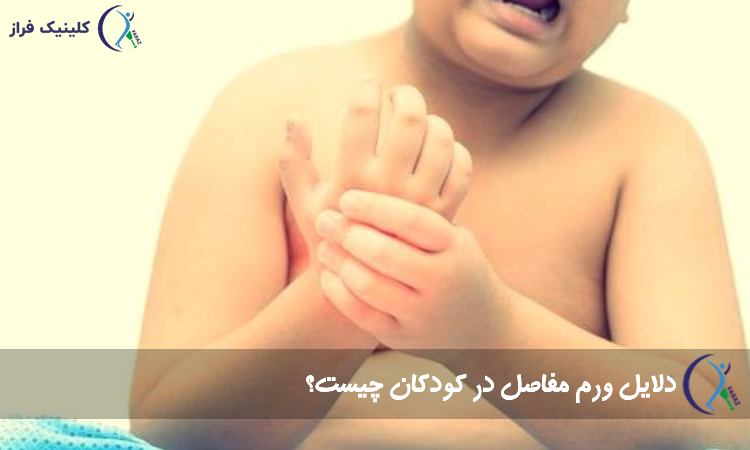 ورم مفاصل در بچه ها