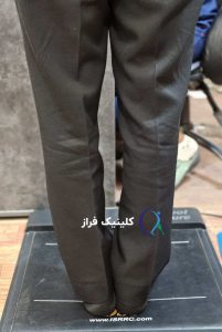 زانوی پرانتزی بزرگسالان
