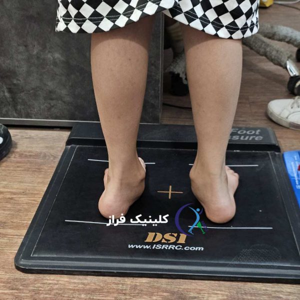 صافی کف پا و تاثیرش در مچ پا