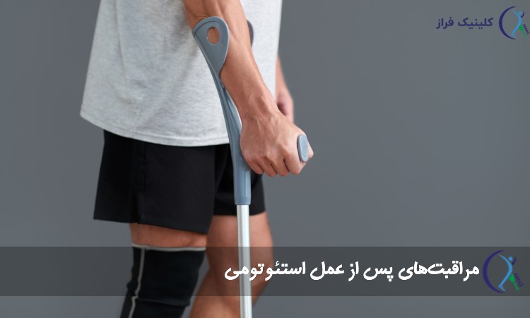 مراقبت‌های پس از عمل استئوتومی