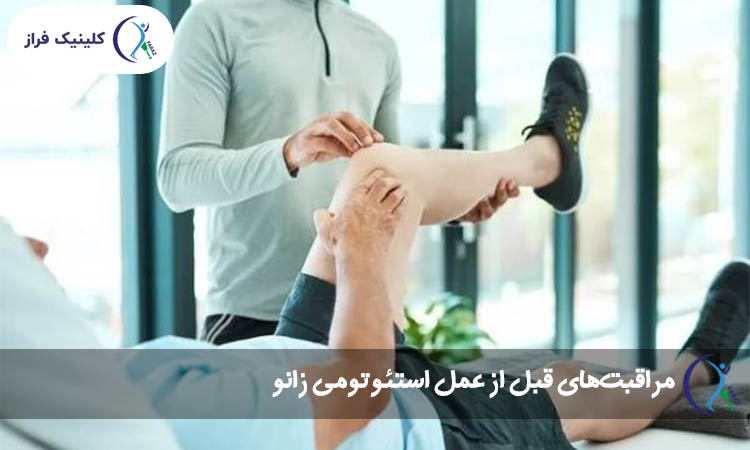 مراقبت های قبل از عمل استئوتومی
