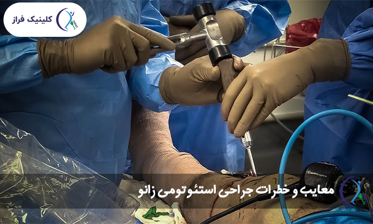 معایب و خطرات جراحی استئوتومی زانو