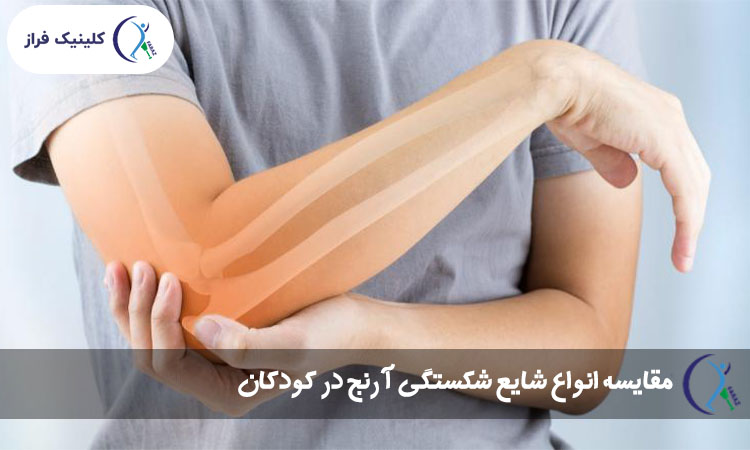 مقایسه انواع شایع شکستگی آرنج در کودکان