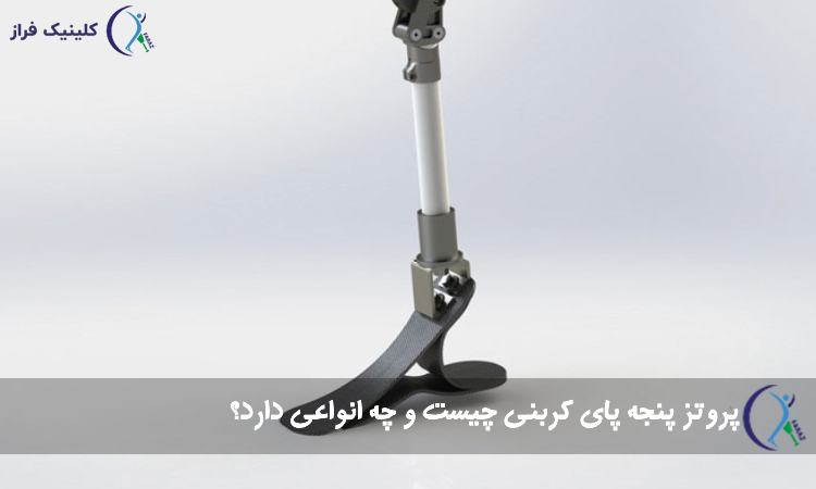 پروتز پنجه پای کربنی