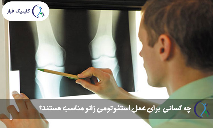 چه کسانی کاندیدای مناسبی برای عمل استئوتومی زانو هستند؟