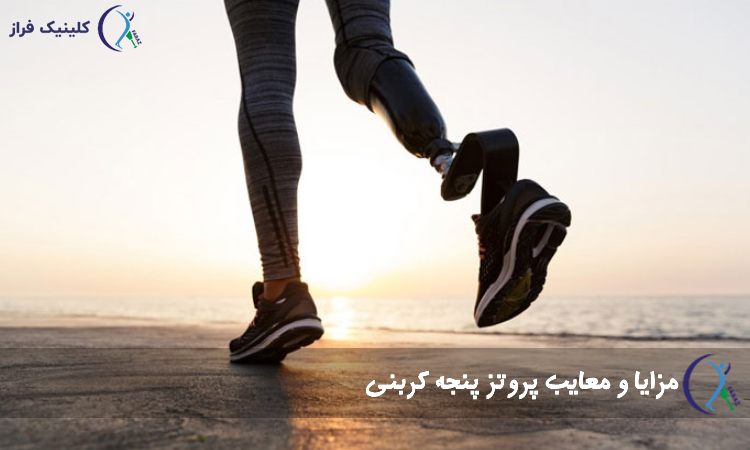 پروتز پنجه پای کربنی
