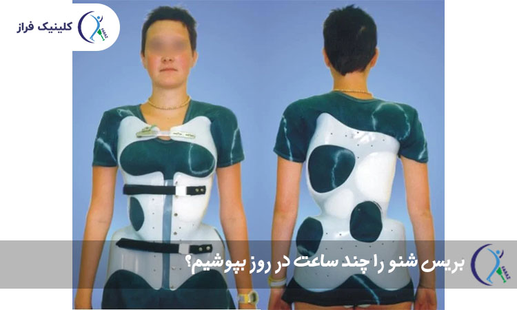 بریس شنو را چند ساعت در روز بپوشیم؟