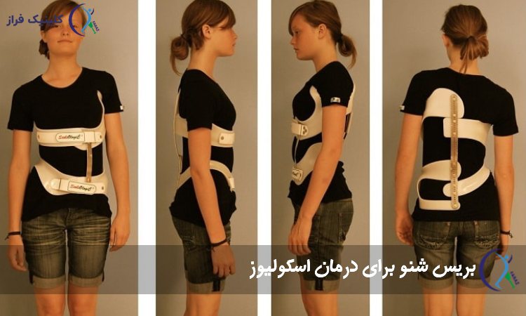 بریس شنو