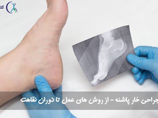 جراحی خار پاشنه