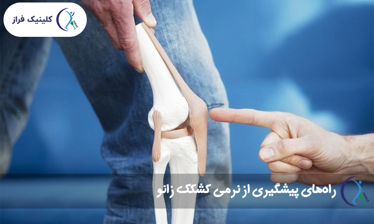 راه‌های پیشگیری از نرمی کشکک زانو