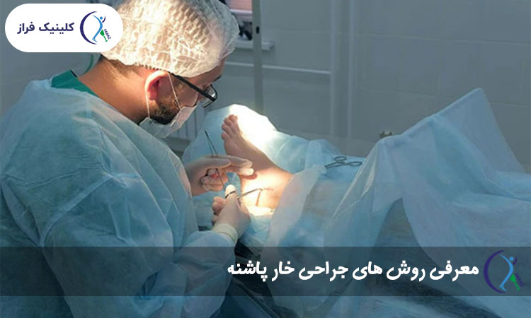 روش های جراحی خار پاشنه
