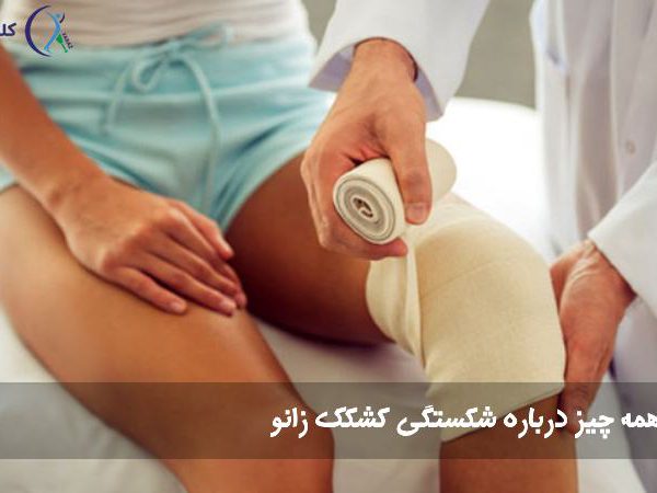شکستگی کشکک زانو