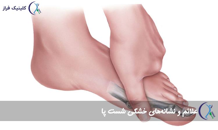 علائم و نشانه‌های خشکی شست پا