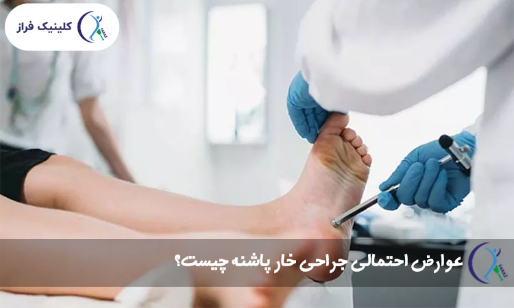 عوارض احتمالی جراحی خار پاشنه چیست؟
