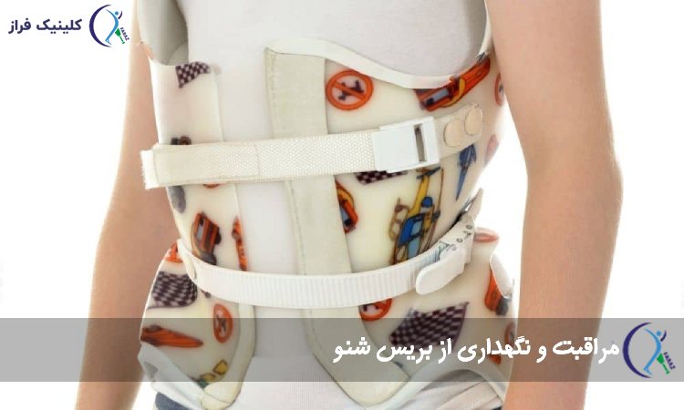 مراقبت و نگهداری از بریس شنو