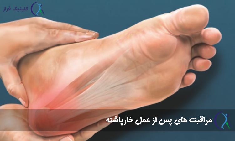 مراقبت های پس از عمل خارپاشنه