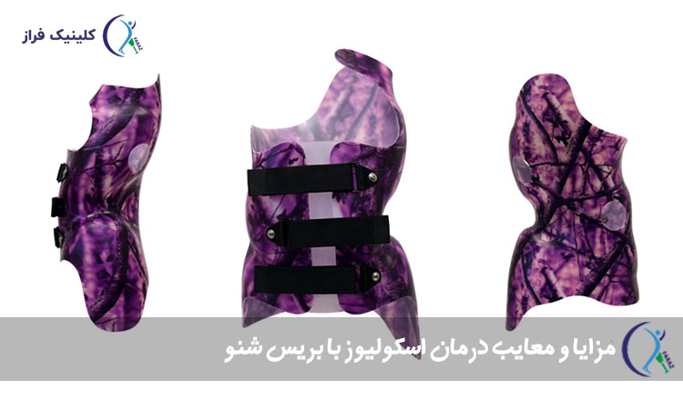 مزایا و معایب درمان اسکولیوز با بریس شنو