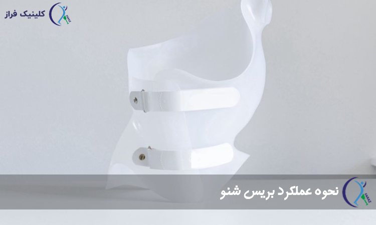 نحوه عملکرد بریس شنو