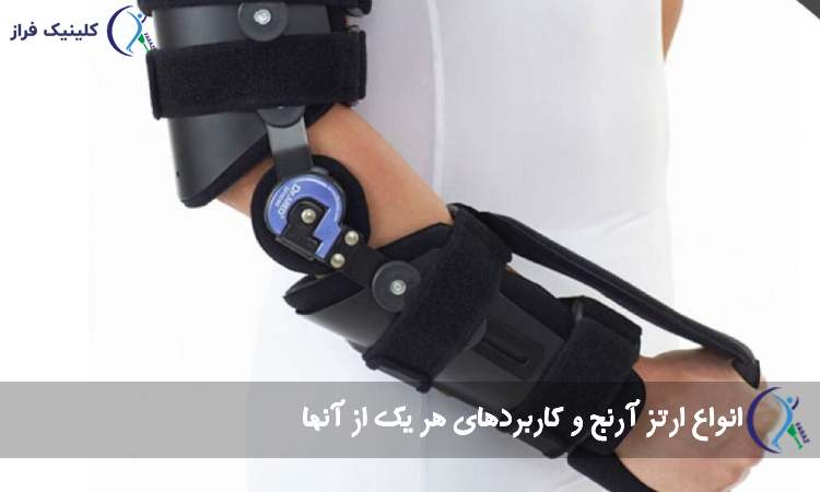 ارتز آرنج