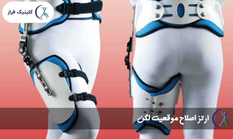 ارتز اصلاح موقعیت لگن