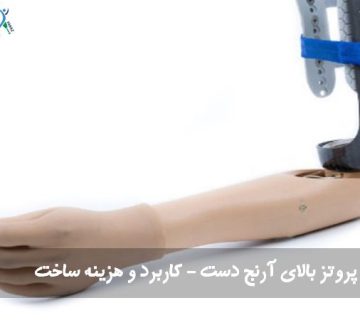 پروتز بالای آرنج دست