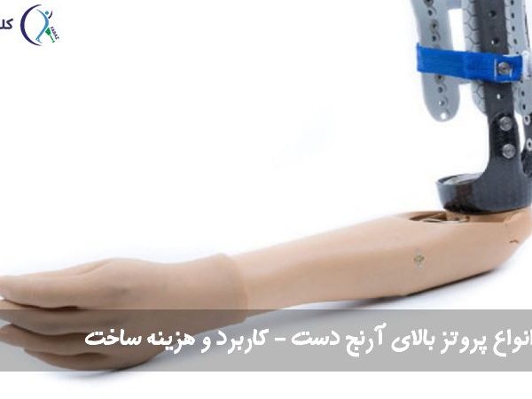 پروتز بالای آرنج دست
