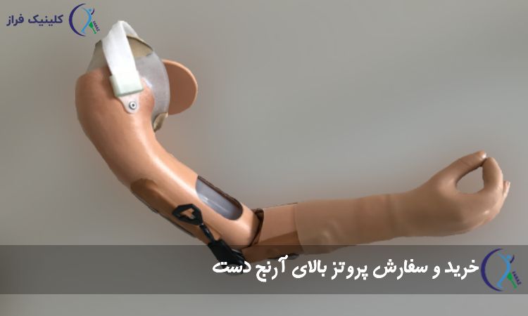 خرید و سفارش پروتز بالای آرنج دست