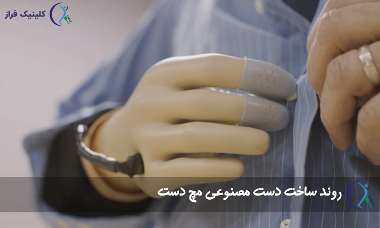 روند ساخت دست مصنوعی مچ دست
