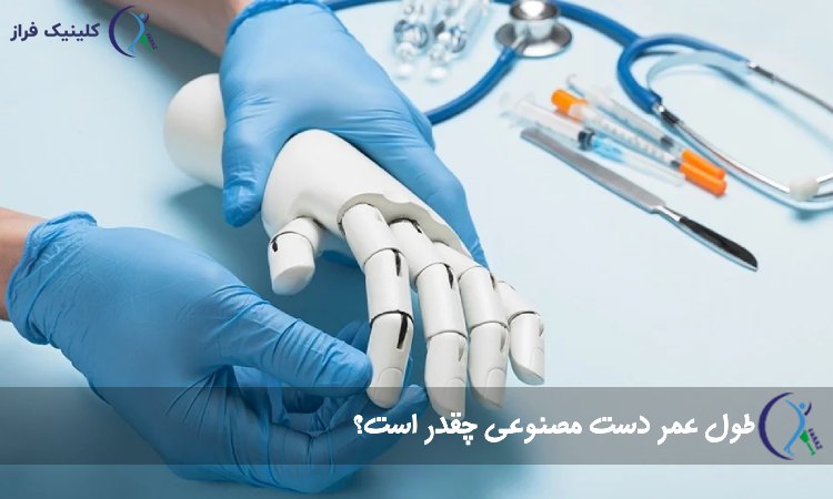 طول عمر دست مصنوعی