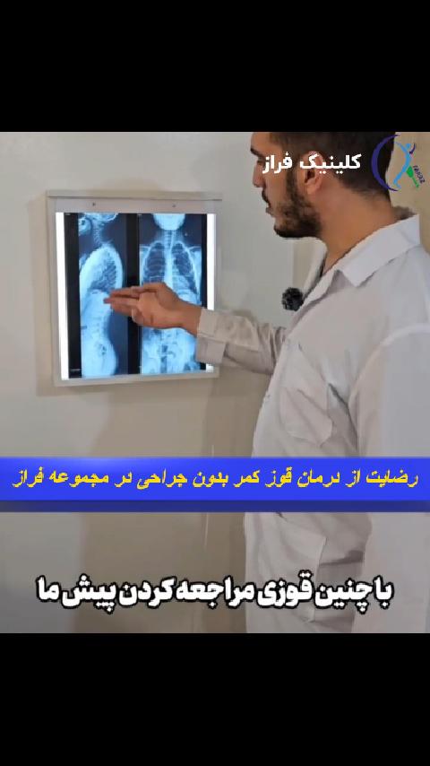 درمان غیر جراحی قوز کمر در کلینیک فراز