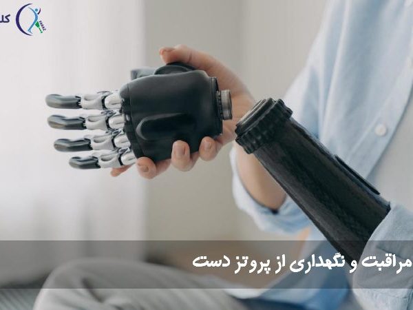 مراقبت از پروتز دست