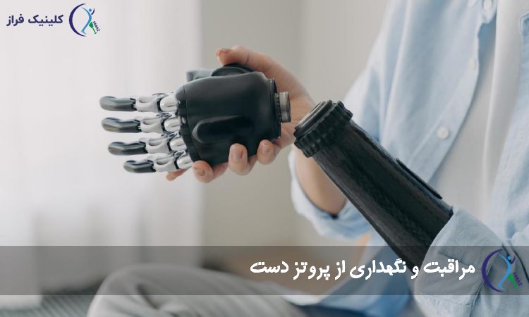 مراقبت از پروتز دست