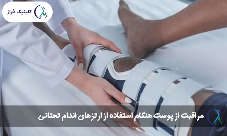 مراقبت از پوست هنگام استفاده از ارتزهای اندام تحتانی