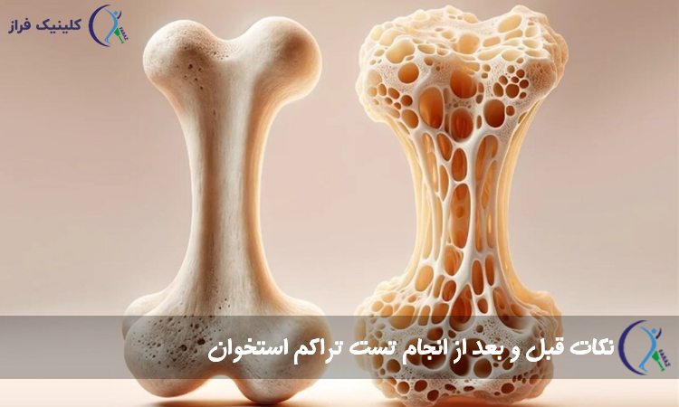 نکات قبل و بعد از انجام تست DXA