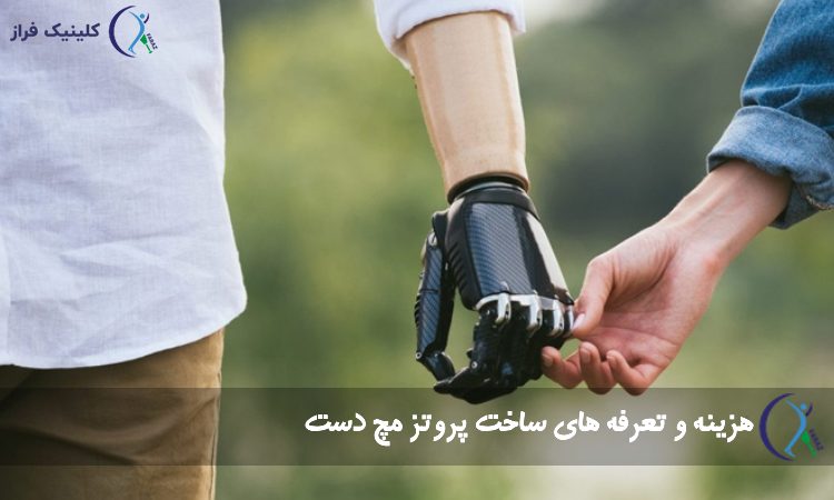 هزینه ساخت پروتز مچ دست