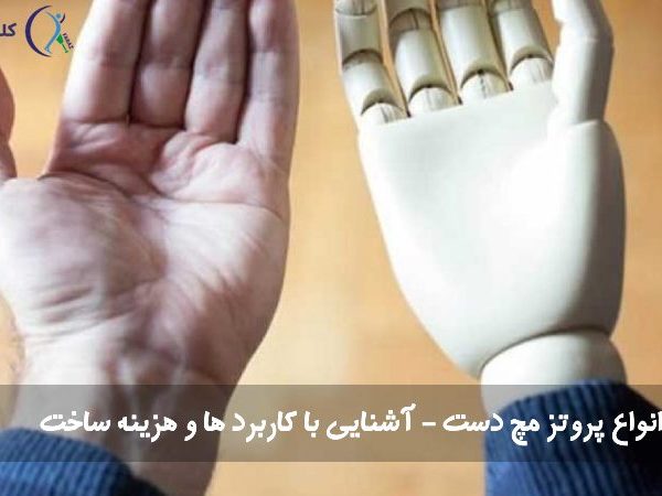 پروتز مچ دست