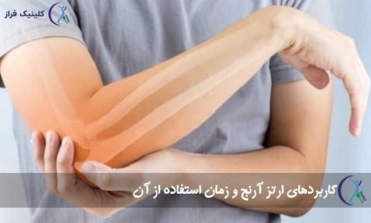 کاربردهای ارتز آرنج