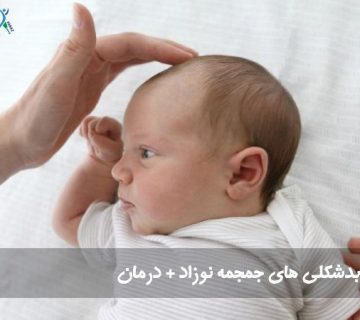 بدشکلی سر 360x320