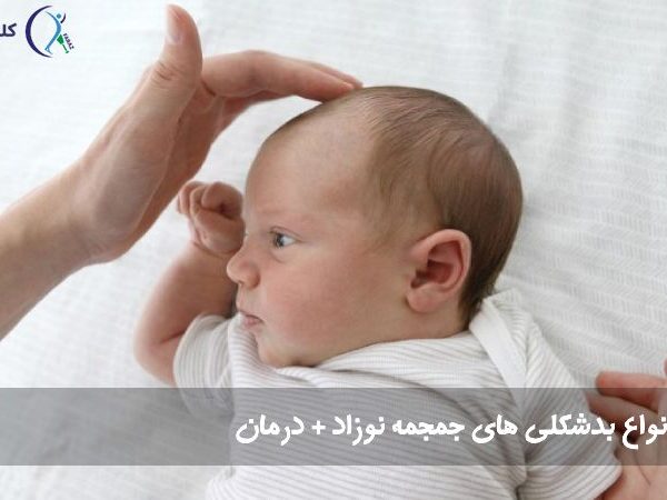بدشکلی سر 600x450