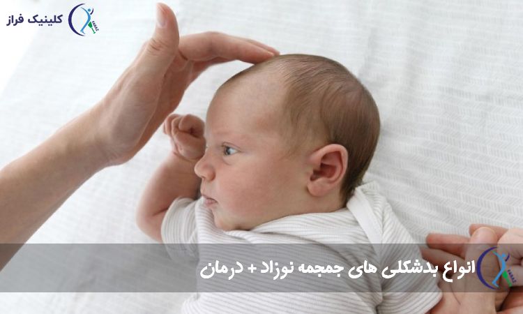 بدشکلی سر