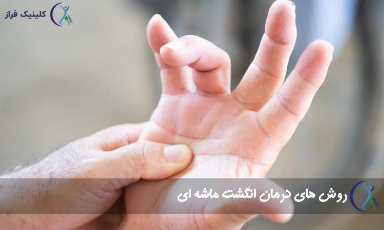 درمان تریگر فینگر